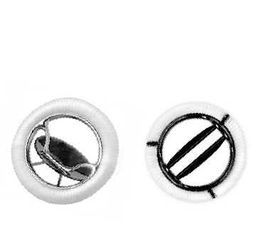 mechanical valve