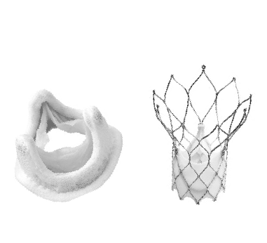 tissue valve